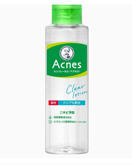 لوشن حب الشباب