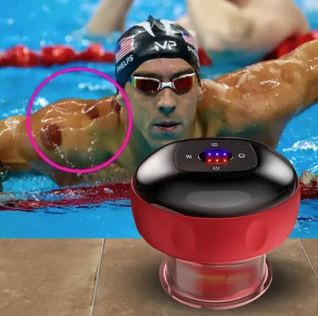 جهاز تدليك علاجي بالحجامة