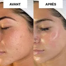 RÉVÉLEZ UNE PEAU JEUNE, LISSE ET ÉCLATANTE AVEC LE MASQUE AU COLLAGENE