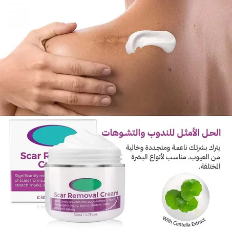 كريم إزالة الندبات