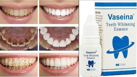 قطرات تزيل البقع الموجودة على الاسنان الناتجة عن التدخين وشرب الشاي