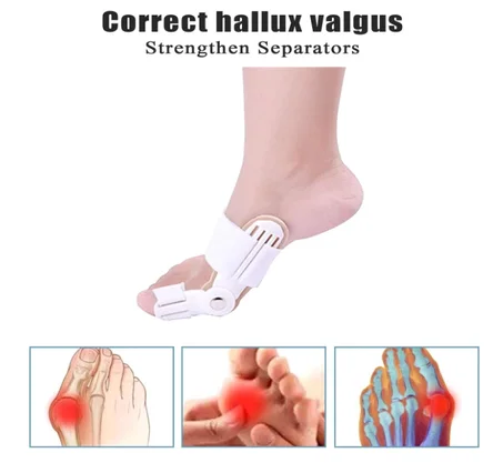 مصحح إبهام القدم