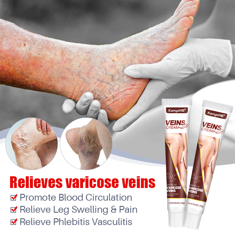 Varicose Veins Relief Cream