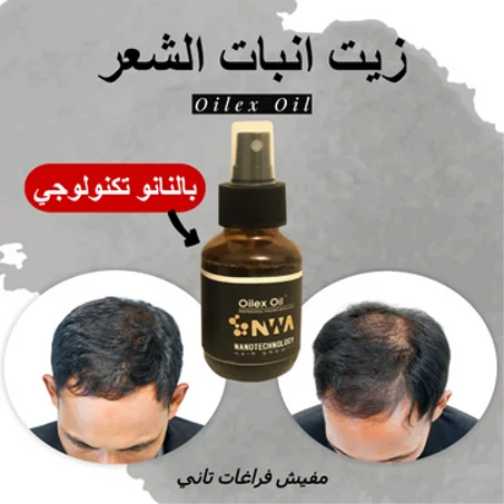 زيت لانبات الشعر والحمايه من الصلع بخصيه النانو تكنولوجي