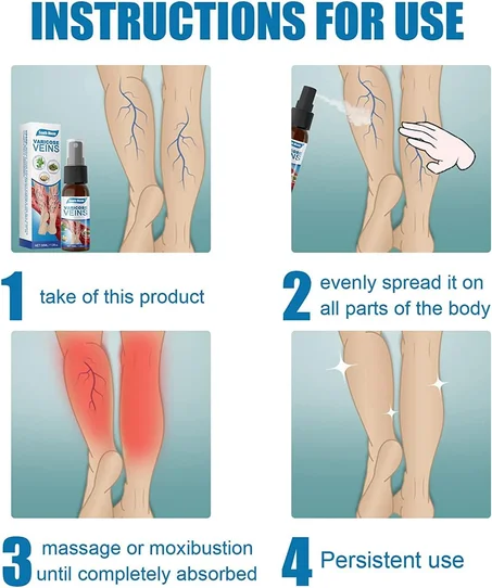 بخاخ ازالة الدوالى المستورد