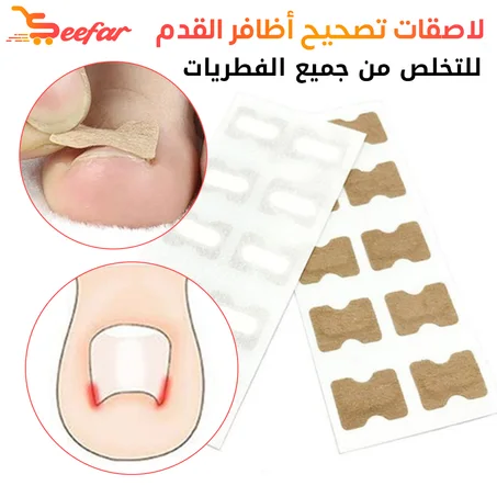 لاصقات تقويم الأظافر و التخلص من جميع انواع الفطريات