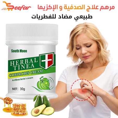 مرهم علاج الصدفية و الإيكزيما herbal tinea corproris cream