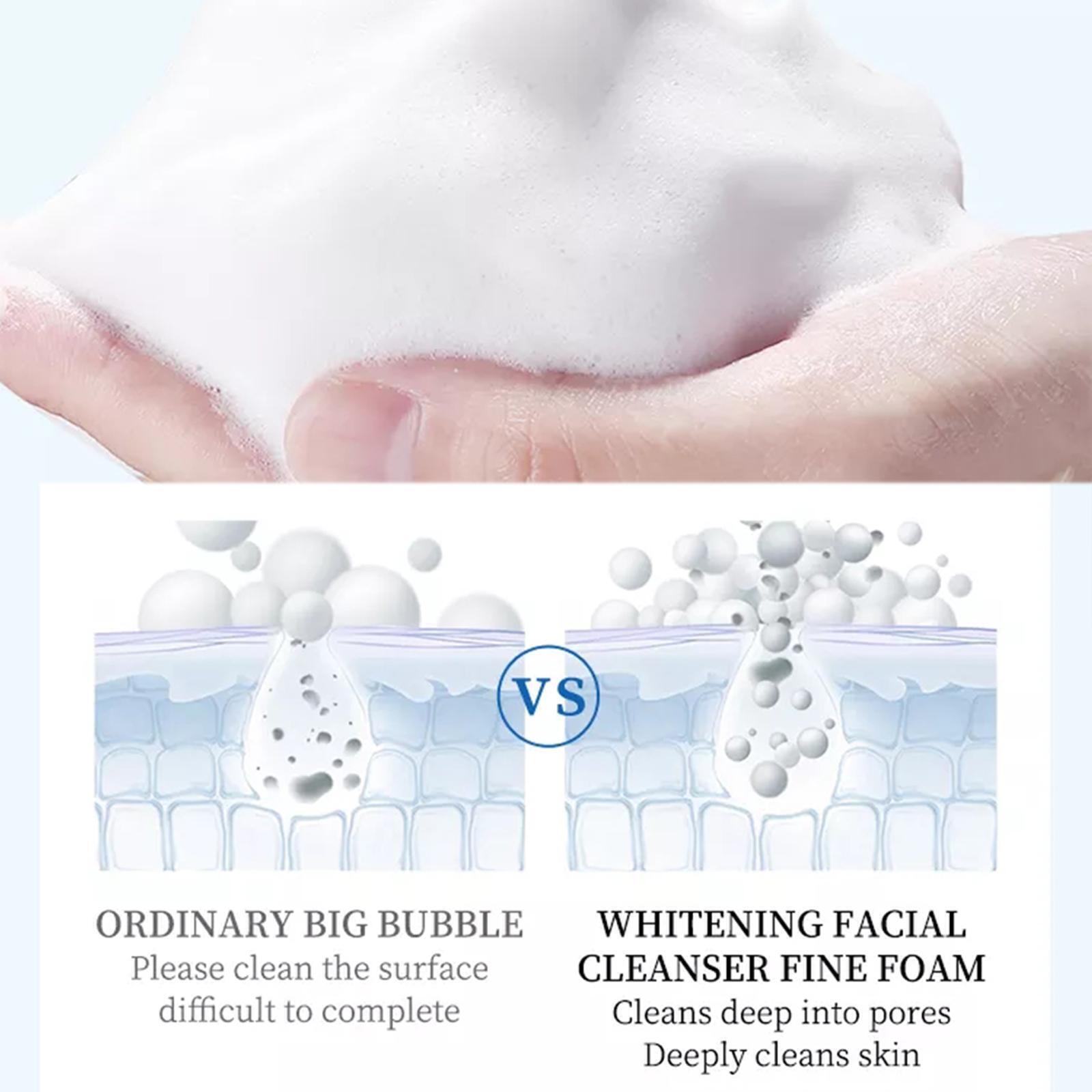 Freckle Remover For Skin Whitening