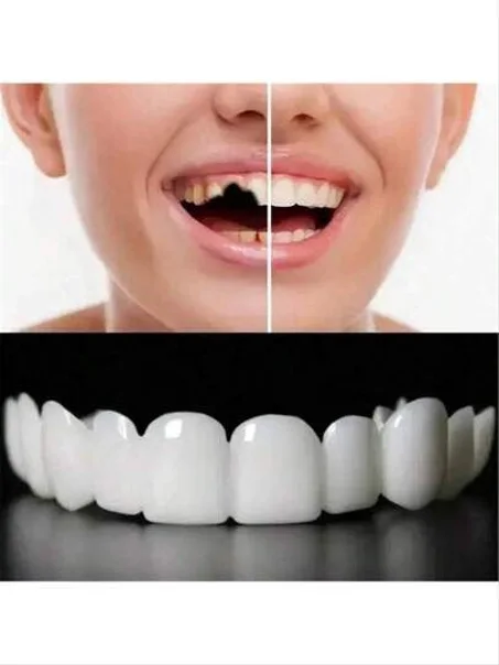 ابتسامة هوليود الفورية – طقم تجميل الأسنان القابل للإزالة (طبيعي ومريح)