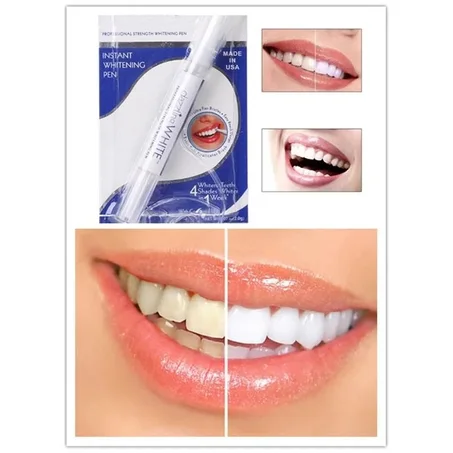 قلم تبييض الاسنان | Dazzling White