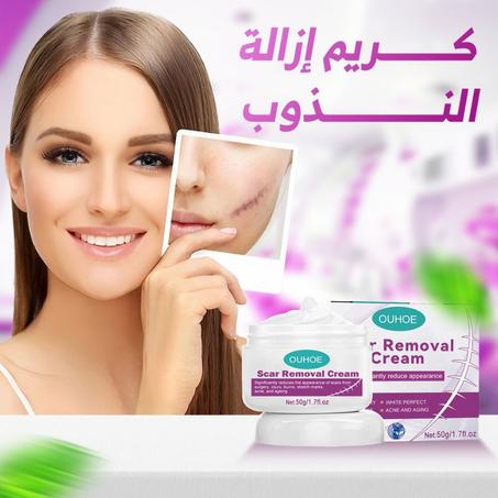 كريم إزالة النذوب scar removal cream