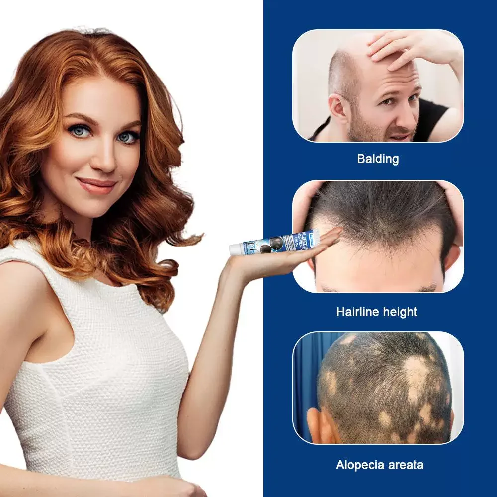 كريم نمو الشعر