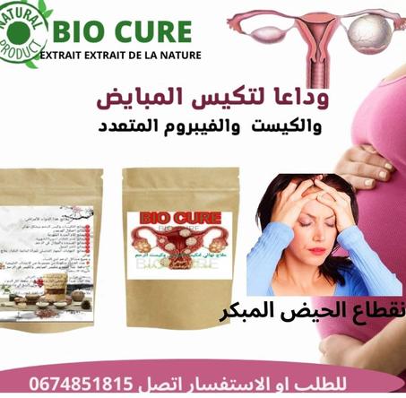 علاج تكيسات المبايض