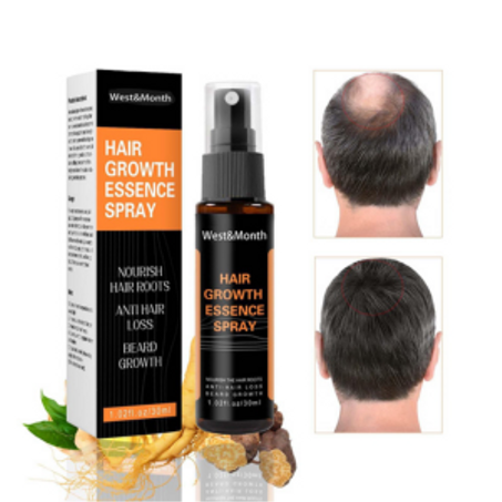 معالجات نمو الشعر