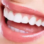 تجميل الأسنان