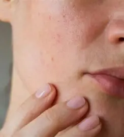 تجميل الوجه