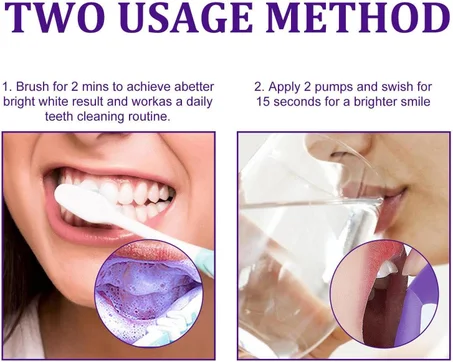 Foam Teeth Whitening - KSA