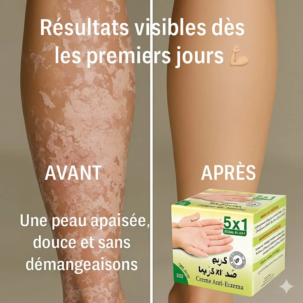 Prise de notes sur écran LCD