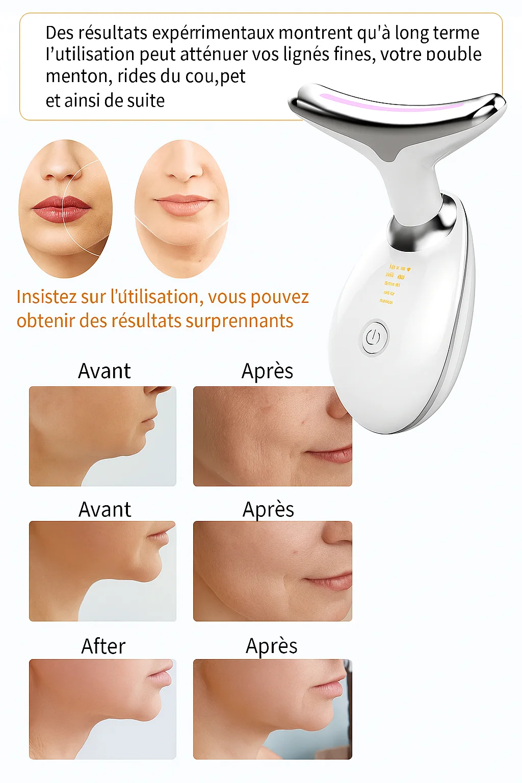 Appareil de Beauté EMS Lifting Visage