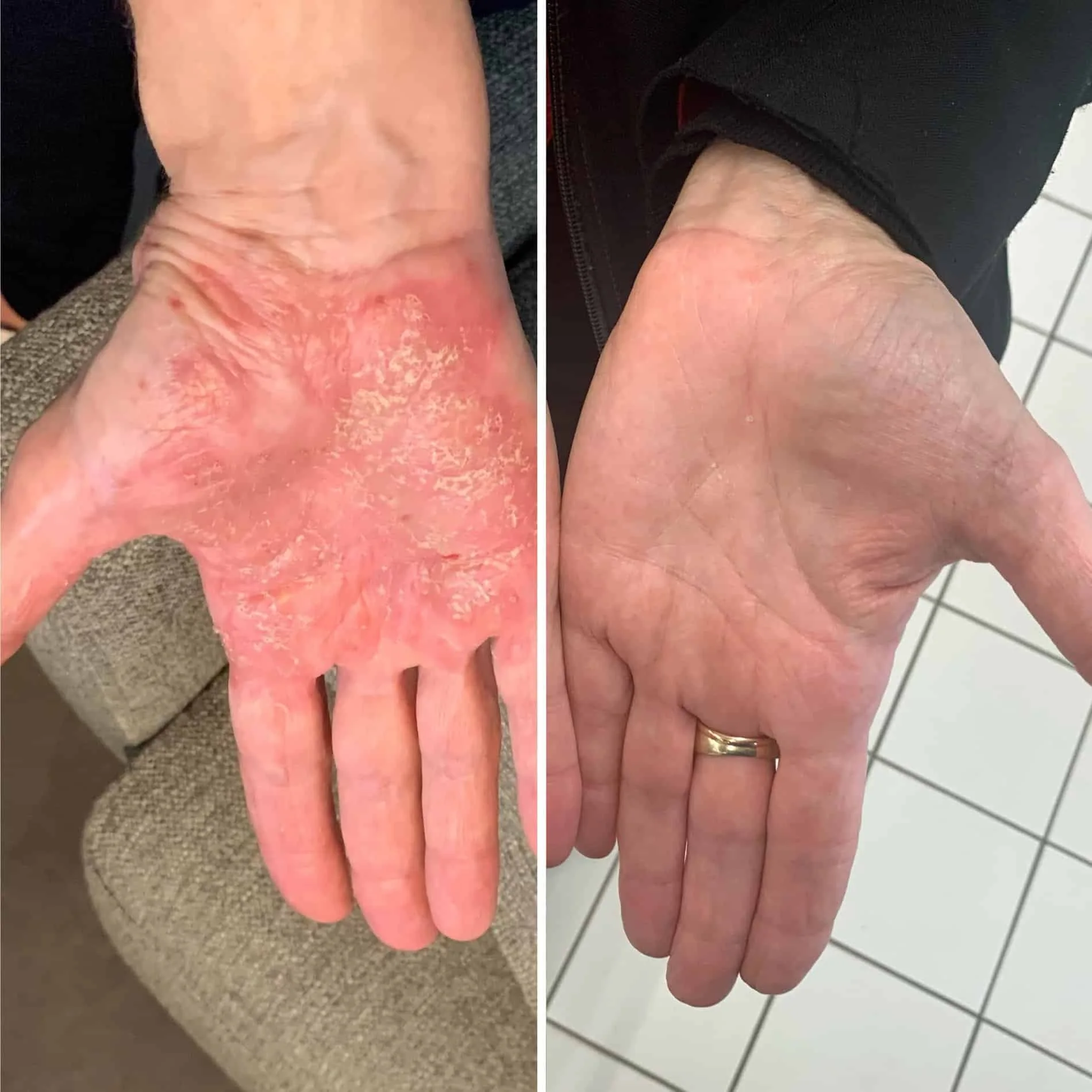 Prise de notes sur écran LCD