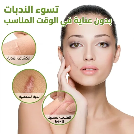 صفائح سيليكون لعلاج الندبات - للندبات القديمة والجديدة