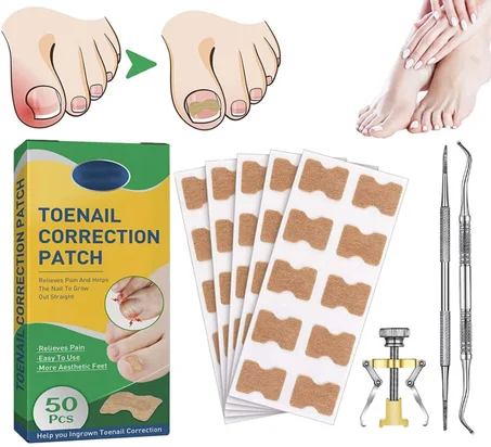 شرائط علاج اظافر القدم النامية