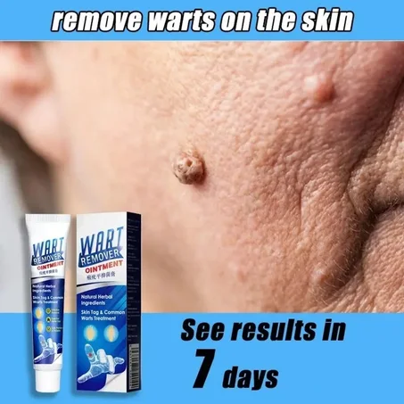 Crème anti-verrues
