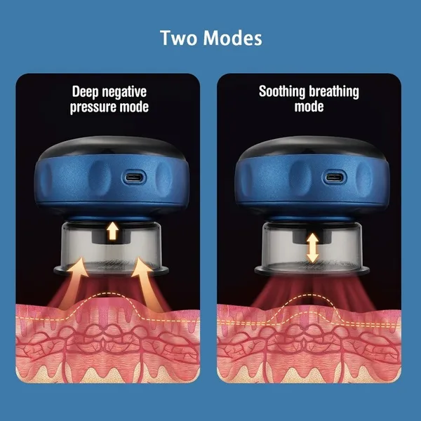 جهاز التدليك والحجامة
