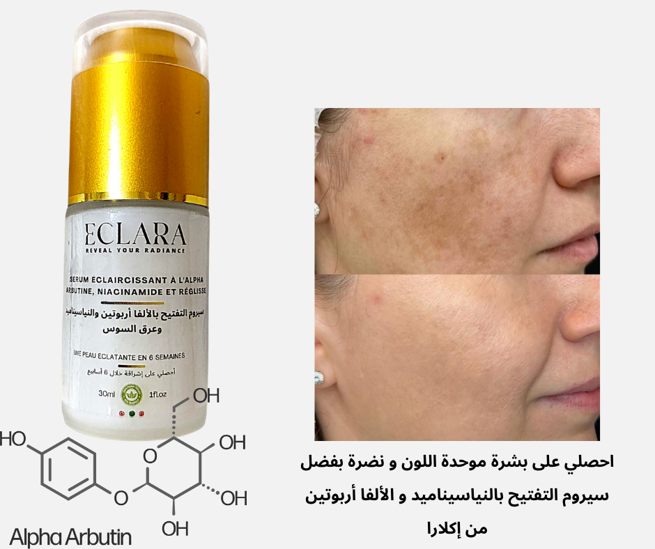 SÉRUM TRIPLE ACTION      سيروم مضاد لفرط التصبغ