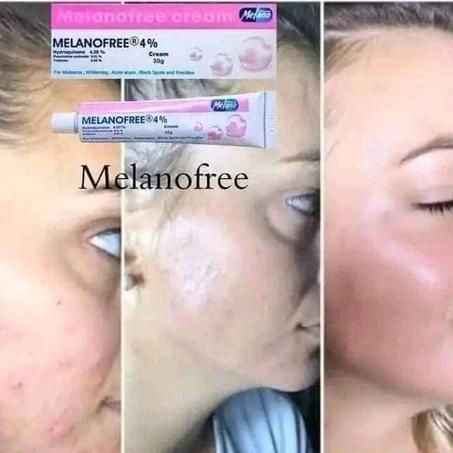 💯 ✨✨ Melanofree cream 💯 ✨✨