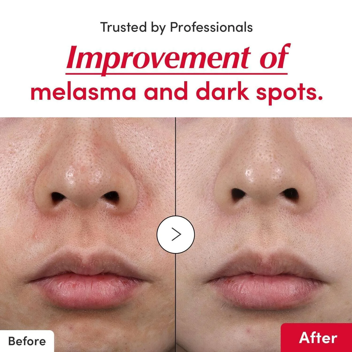 سيروم فيتامين C المركز + نياسيناميد – إشراقة فورية وتقوية البشرة من أول استعمال