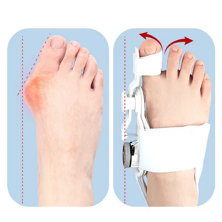 مصحح للبروز العظمي للنساء والرجال