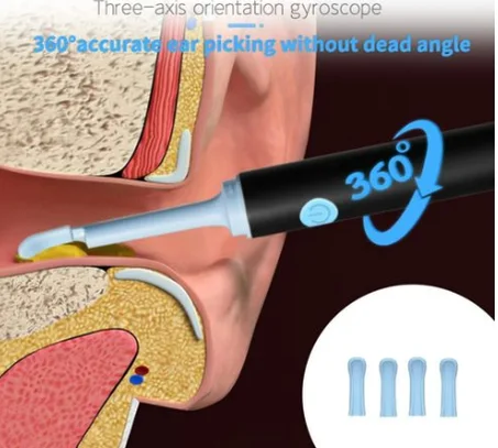 تلسكوب تنظيف الأذن