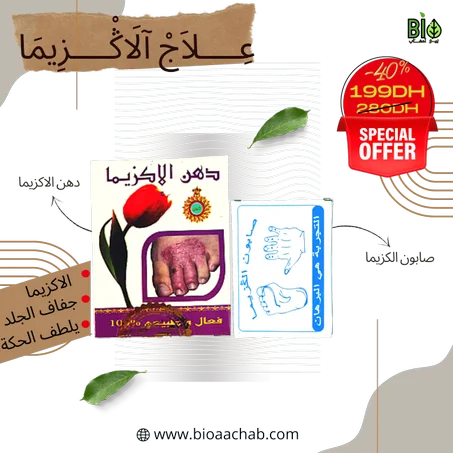 علاج الأكزيما Eczema treatment