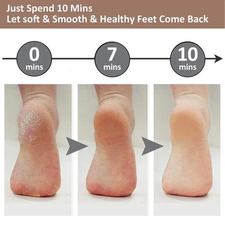 جهاز مبرد القدمين Electric Pedi