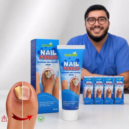 كريم علاج فطريات الأظافر