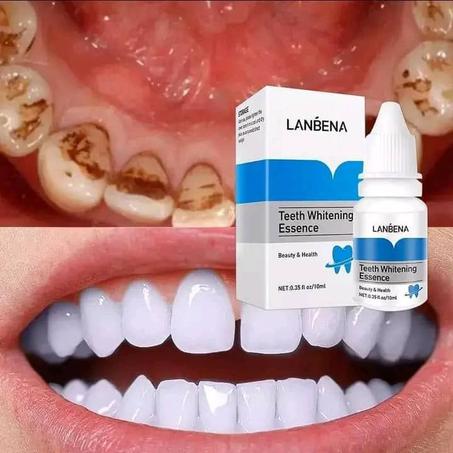 مبيض الاسنان \ Blanchisseur de dents LANBENA