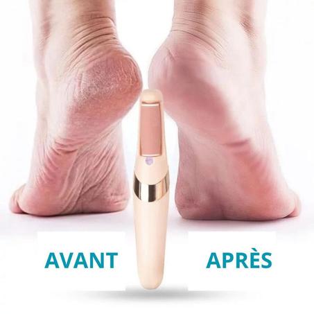 Appareil électrique portable pour pédicure et élimination des callosités des pieds