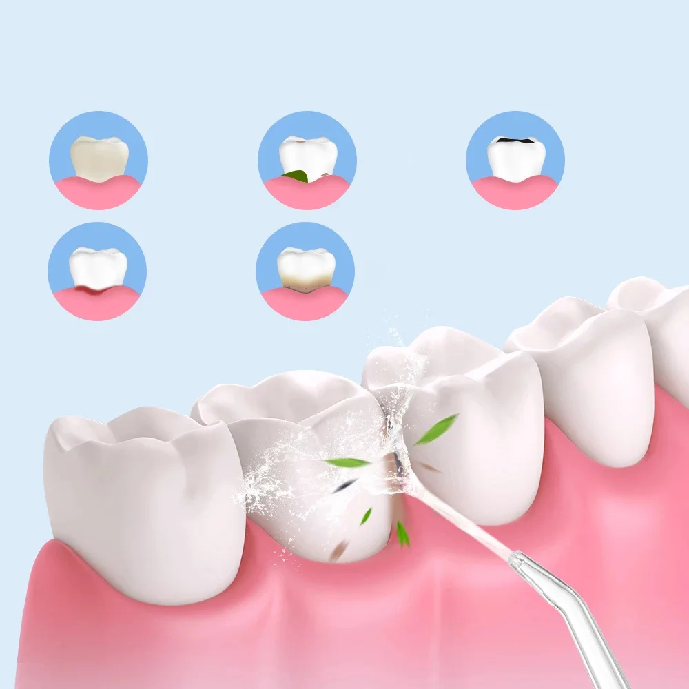 جهاز تنظيف الأسنان المائي - water flosser