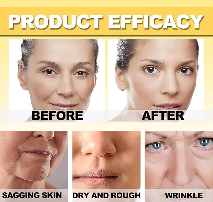 botox bee venom Cream عرض قطعتين