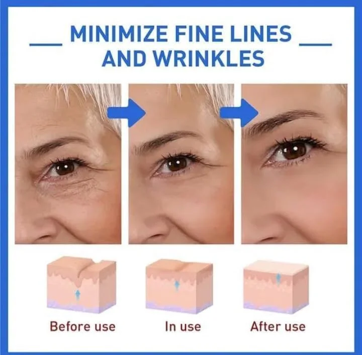 عرض ثلاث قطع Botox face serum