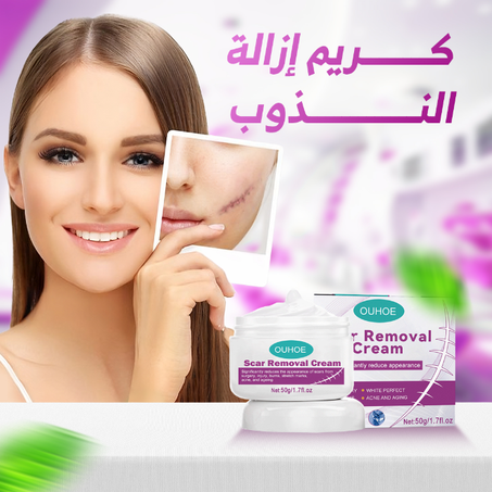 كريم إزالة الندوب السحري