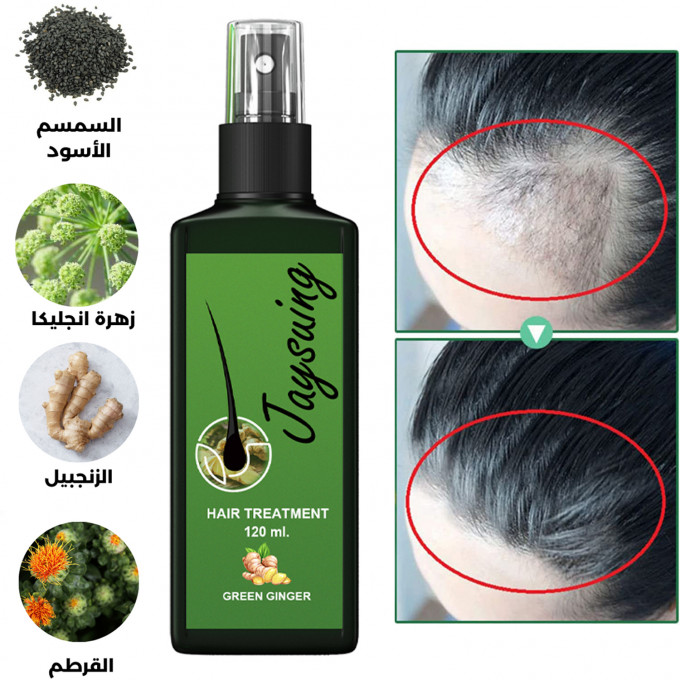 بخاخ الزنجبيل Jaysuing الأصلي لعلاج تساقط الشعر والصلع الأكثر مبيعا  Ginger Hair Growth Nourishing Spray