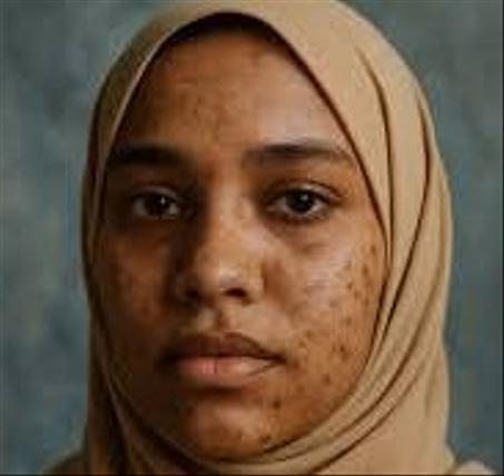 كريم الاكريتين السحري