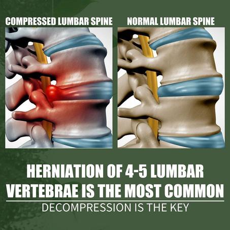 رذاذ جل الذهب