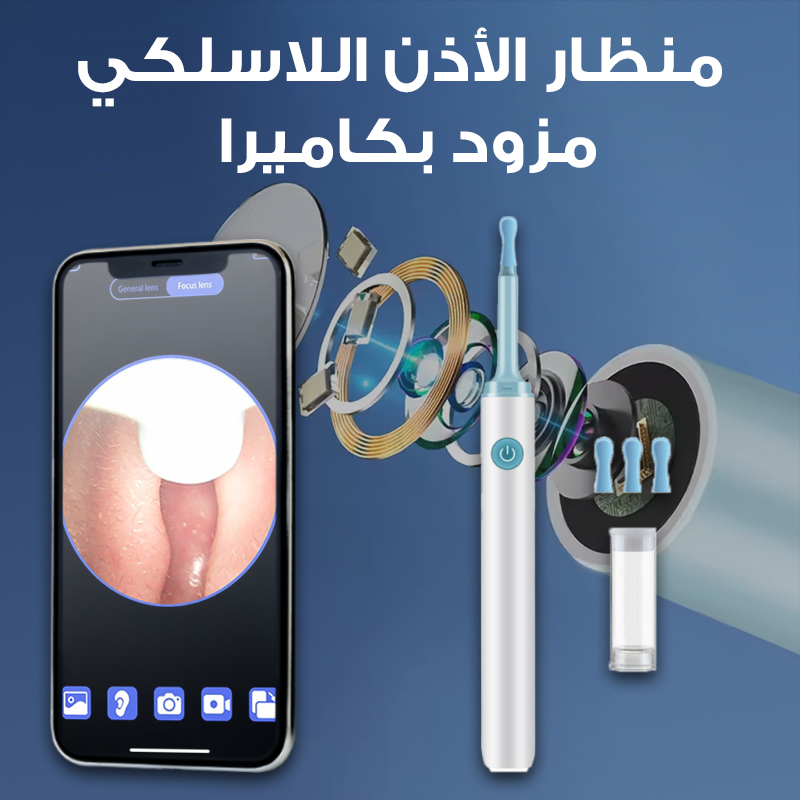 منظار الأذن اللاسلكي