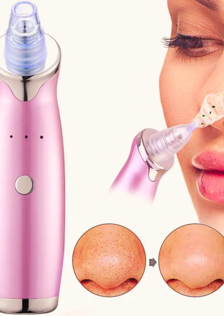 جهاز إزالة النقط السوداء