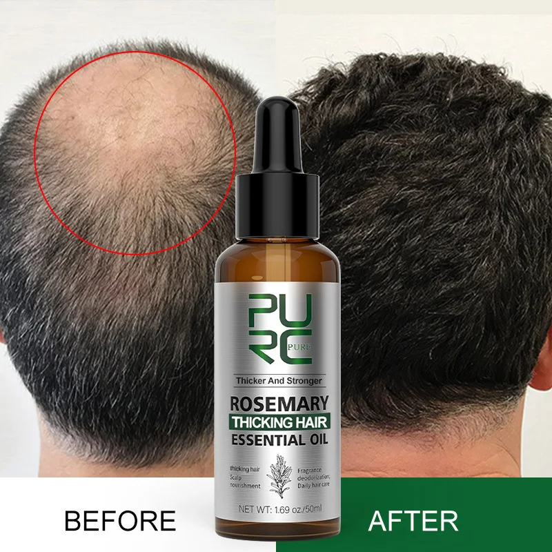 Rosemary Hair Growth Oil