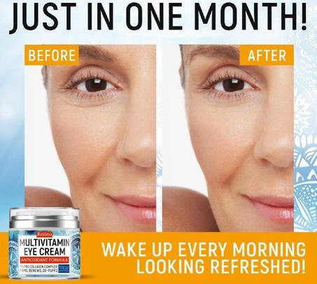 Anti-Aging Eye Cream حل المناسب للهالات السوداء تحت العين مصدر إزعاج للمرأة لأنها تجعلها أقل جاذبية و جمآلا و تعطي إنطباعا للآخرين بأنها  مرهقة أو تعاني من مرض