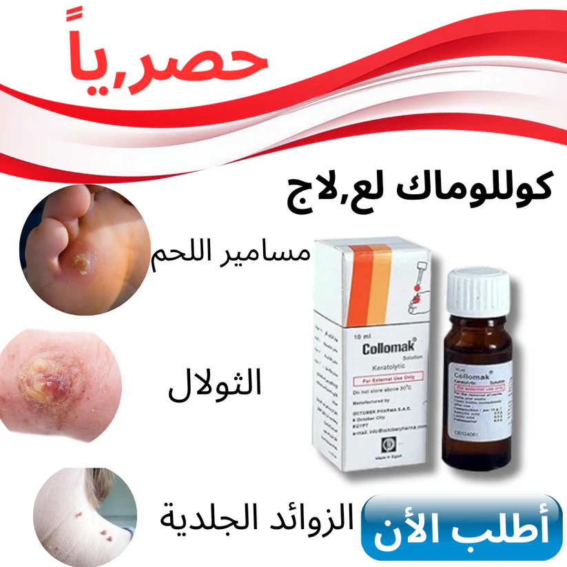 المنتج رقم 1 للقضاء على الثالول في الوطن العربي